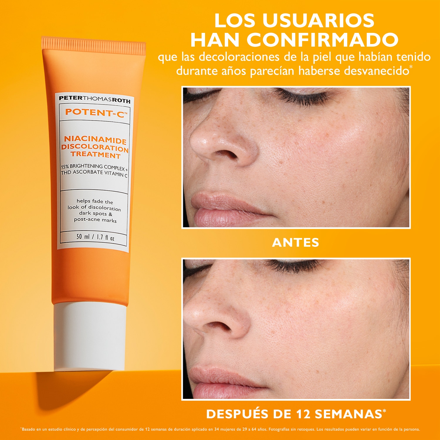 POTENT-C™ NIACINAMIDE DISCOLORATION TREATMENT (GEL-CREMA.FACIAL)